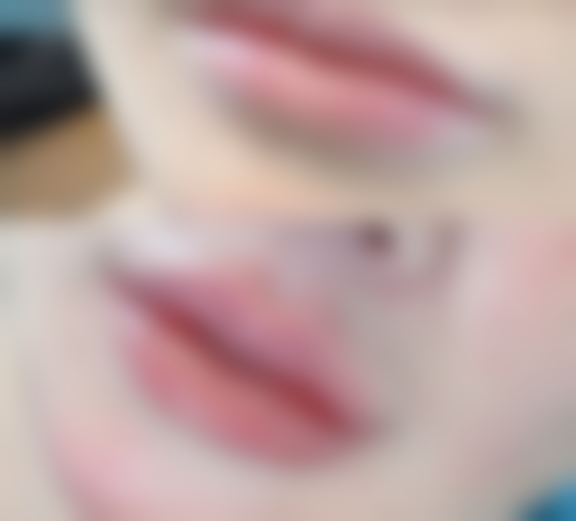 术后1 - 2天内吃鸡蛋会加重肿胀吗？