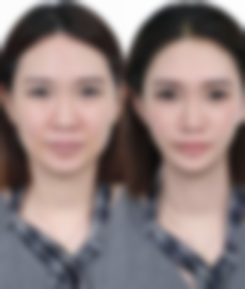 哈尔滨李翔整形医院正规吗?