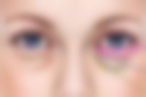 有哪些护理方法能帮助刚形成的疤痕增生修复呢？