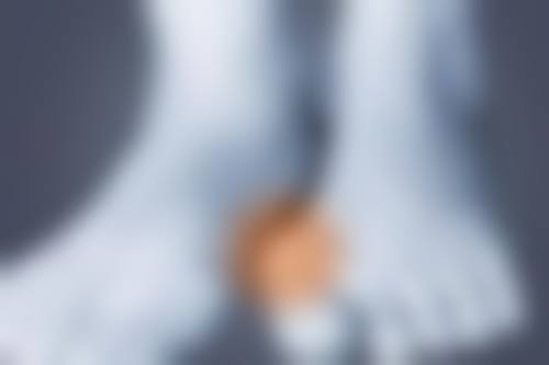 脸上摔伤留下白色疤痕怎么去掉？激光治疗、涂抹药膏等方法能否有效去除？ 