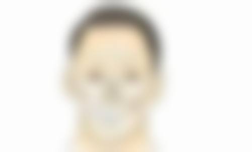 选择医院和医生对夏天做埋线双眼皮重要吗？