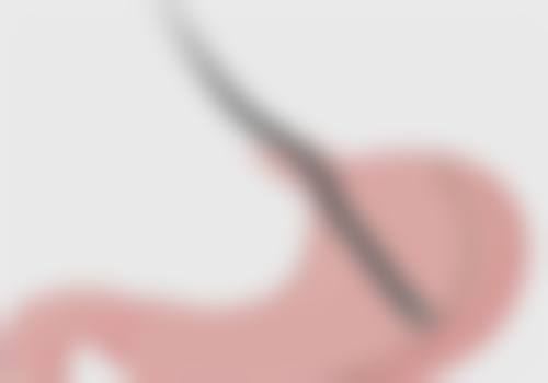 厦门174医院整形美容科杨新蕾医生擅长项目