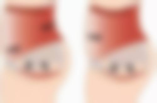 眼袋是怎么形成的呢？