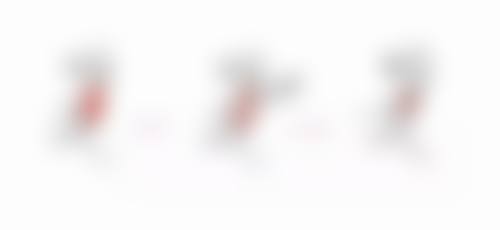 那如果眼袋比较重度，应该选择什么方法去除呢？