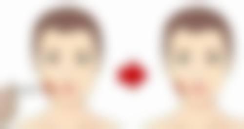 胶原填充后因并发症导致眼袋形成怎么处理?