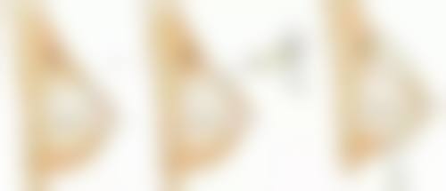 胶原填充泪沟出现了眼袋怎么办？可通过按摩、热敷或专业修复手段来有效改善！ 