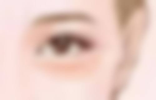 因胶原蛋白质量差或注射部位不对导致出现眼袋怎么办?