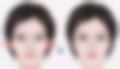 郑州美林整形美容医院如何口碑评价怎么样?