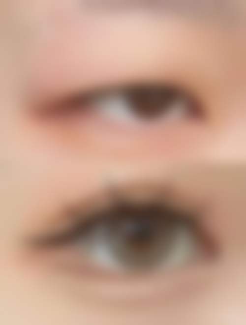 上海华澳整形美容医疗中 心邱梦玲医生预约挂号指南