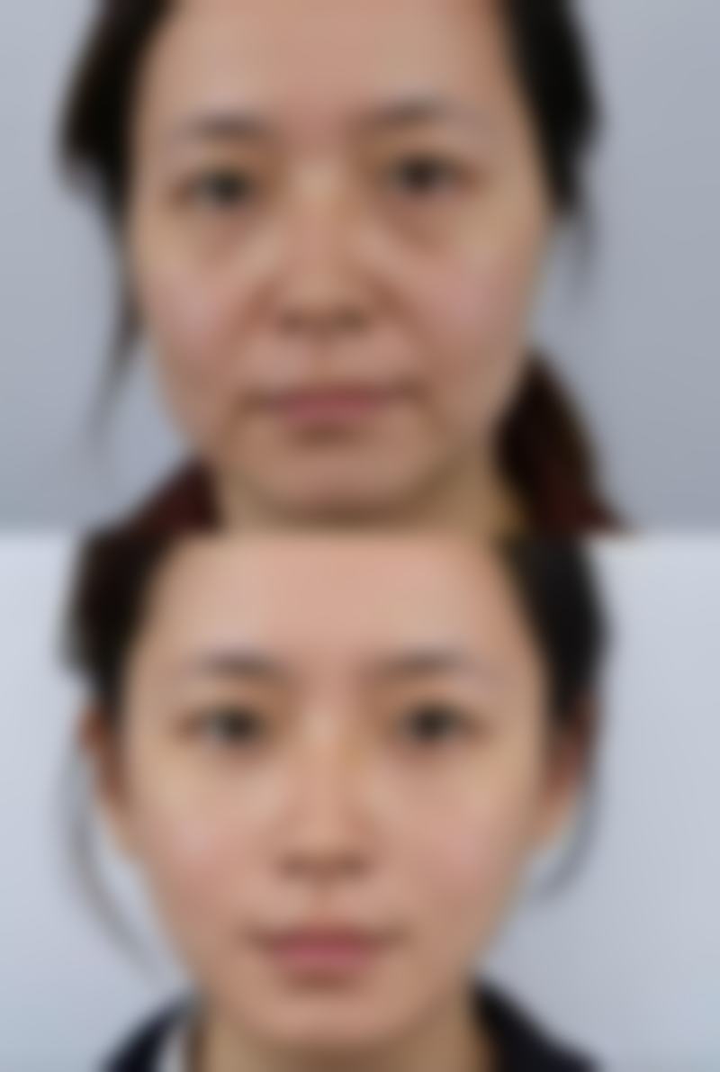 淘宝上便宜的去眼袋贴能用吗?