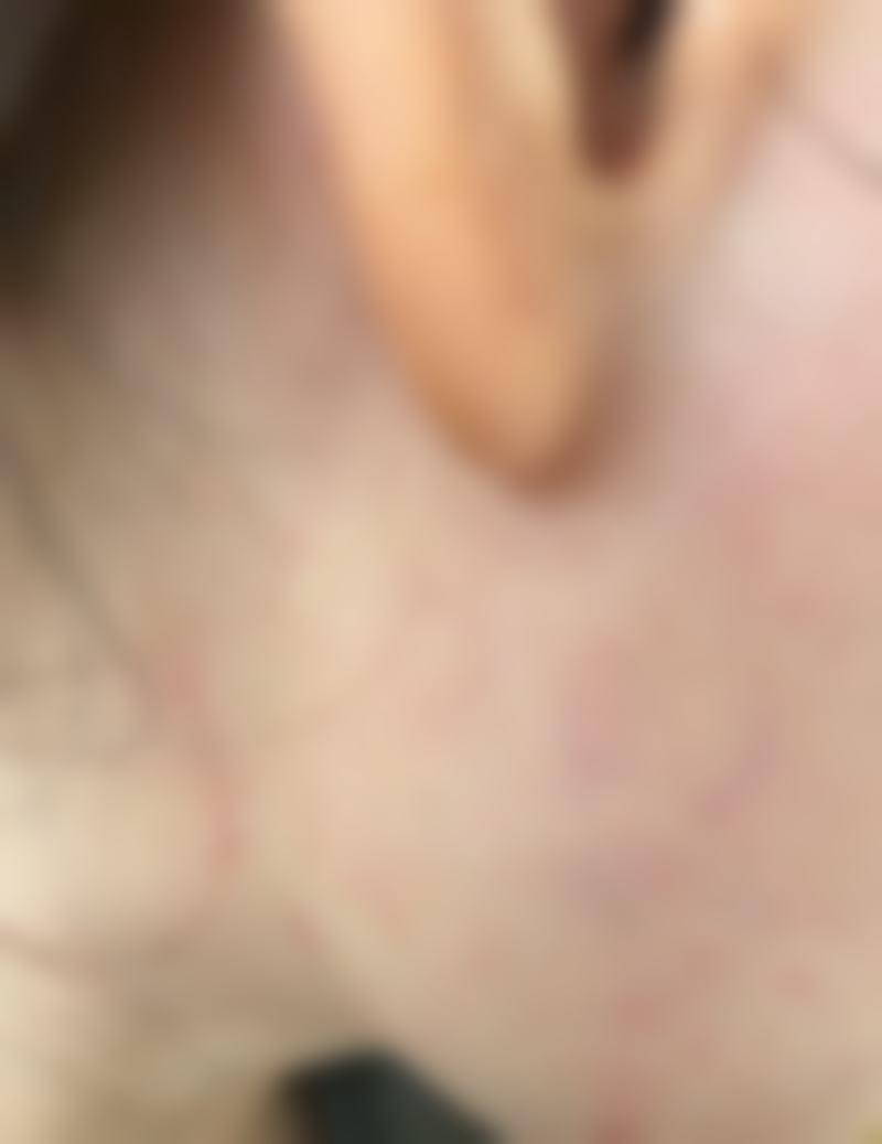 广东韩妃医疗美容医院医美项目体验：首次到院体验佳，效果待显我满怀期待！ 