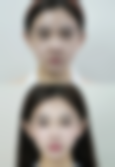 吸脂吃什么快速消肿？冬瓜薏米粥、南瓜汤等消肿食物了解一下！ 