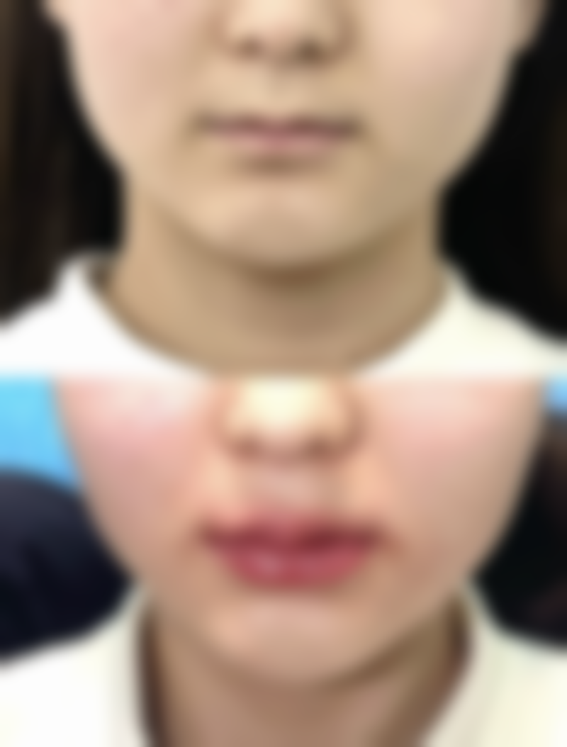 焦作理想俪人医疗美容诊所口碑评价怎么样？