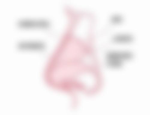 手术联合放疗能治疗什么样的疤痕疙瘩？