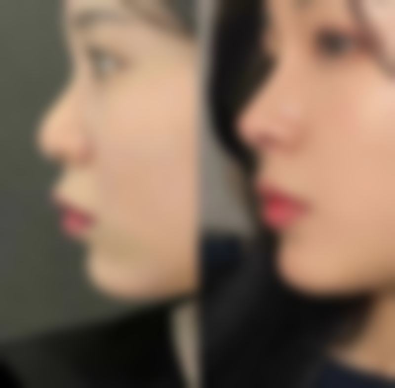 湛江卓真医疗美容口碑评价怎么样？