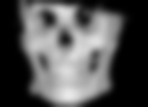 光子嫩肤和瘦脸针联合有什么美学成效及注意事项呢?