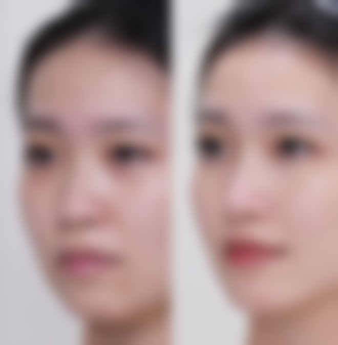 成都莱雅医疗美容诊所正规吗？