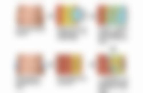 生活美容及日常护理对消除眼袋和细纹有帮助吗？具体怎么做？