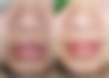 福清天宝美容整形医院正规吗？