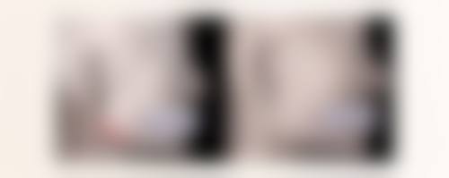 韩国1mm整形外科口碑评价怎么样？