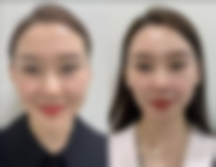 网上卖的除眼袋眼霜对不同类型的眼袋成效如何？