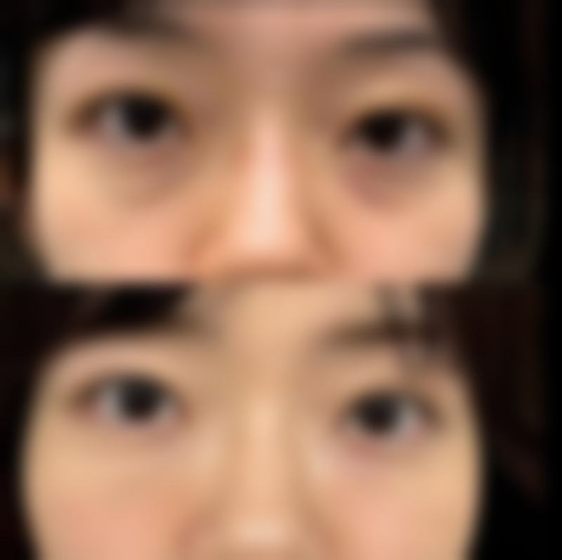 如何选择适合自己的网上除眼袋眼霜？