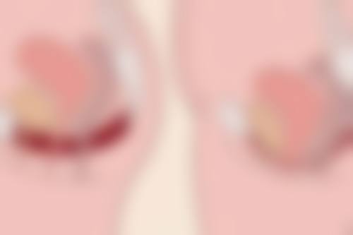 割双眼皮让眼睛变大有哪些局限性？