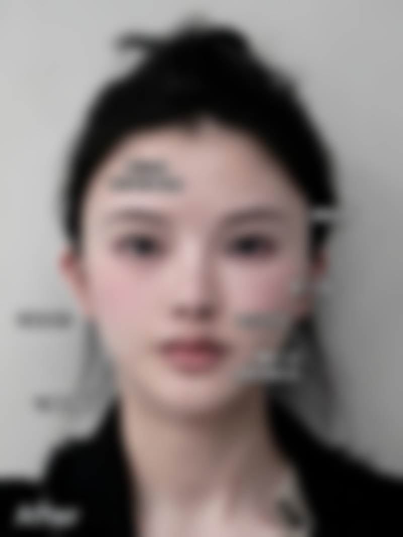 西安艺星医疗美容医院李国玲的技术特点