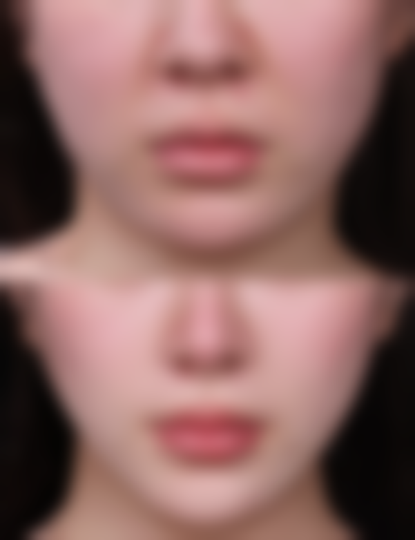 饮食方面该如何调理？