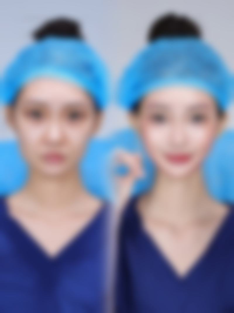 成效能维持多久？