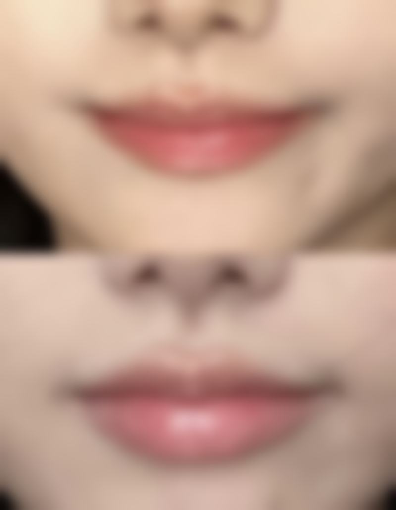 修复难度有何不同？