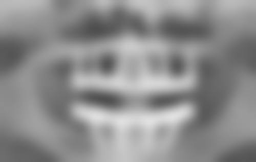 割双眼皮可以吃鸡蛋吗？答案是能，鸡蛋助恢复，术后适量吃好处多！ 