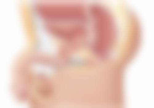 如果不符合抽脂条件，还有啥替代方案吗？