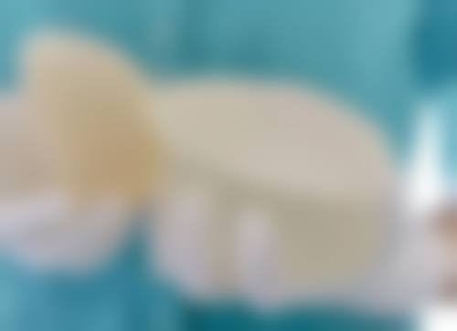 如果对鸡蛋过敏,割双眼皮后该怎么办呢?