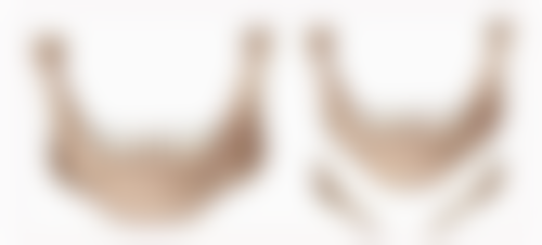 杭州华实医院·私密整形怎么预约