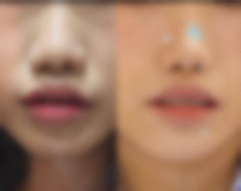 杭州华实医院·私密整形口碑评价怎么样？