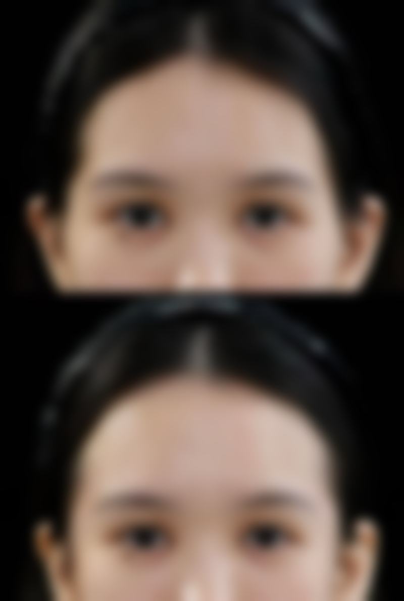 泉州维密医疗美容门诊部陈宝贵医生鼻部整形技术怎么样?