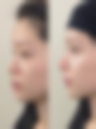 无锡第三人民医院烧伤整形科黄崇根医生社会职称