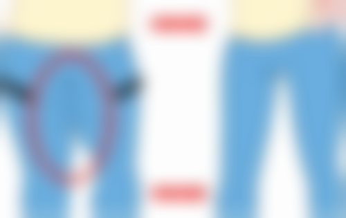 广州壹加壹整形美容医院姚文波医生预约挂号指南