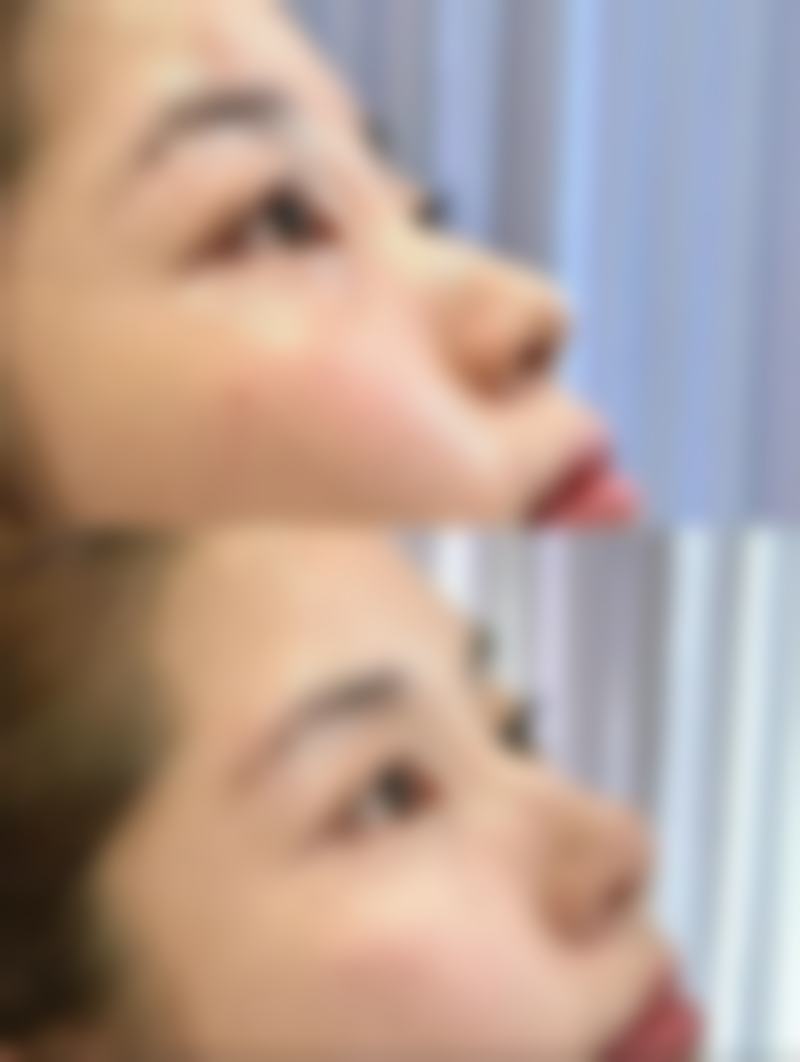 常州美纪医疗美容门诊部王惠杰医生擅长项目