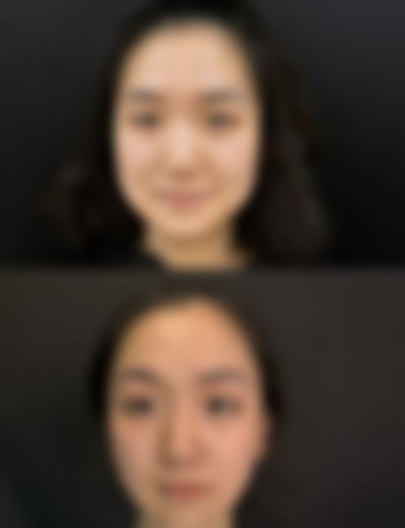 临沂艾佳医疗美容口碑评价怎么样？