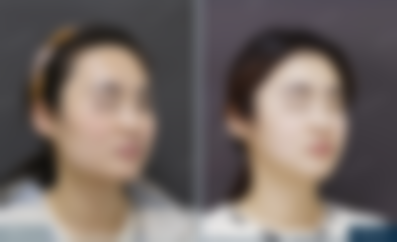 北京圣嘉新医疗美容医院术后修复有啥小秘密呢？