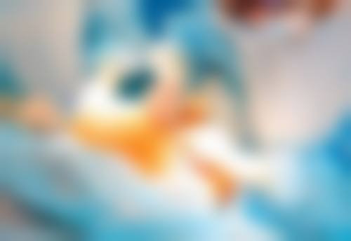 全切双眼皮修复自然受哪些因素影响？