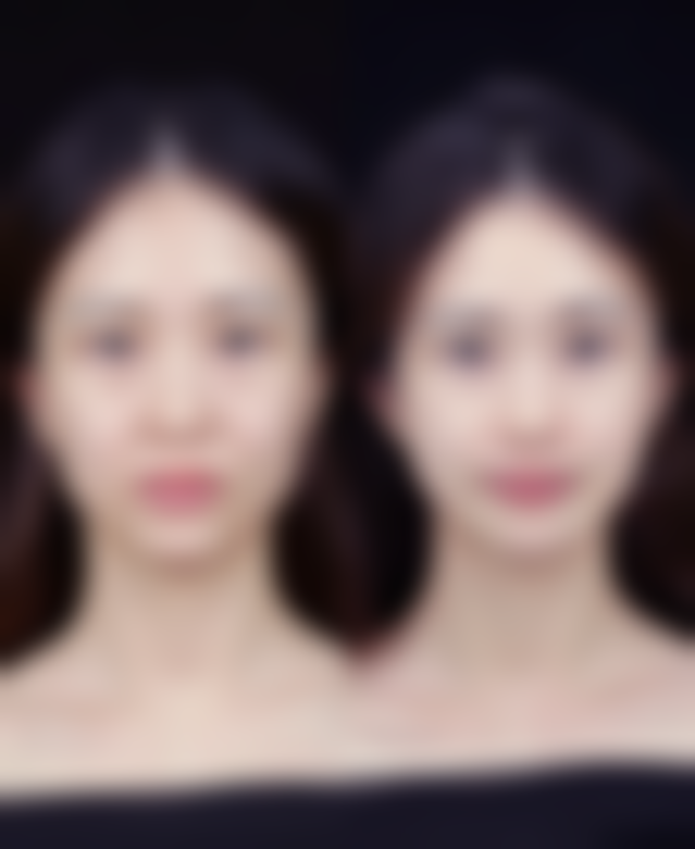 术前需要做哪些检查？