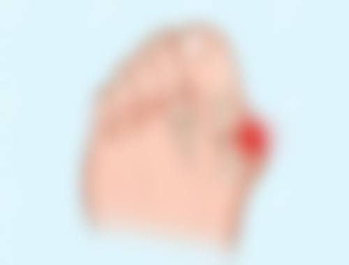 厦门174医院整形美容科李正晔医生擅长项目