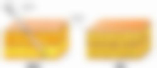 隆鼻术后早期（1 - 2周）要注意什么？