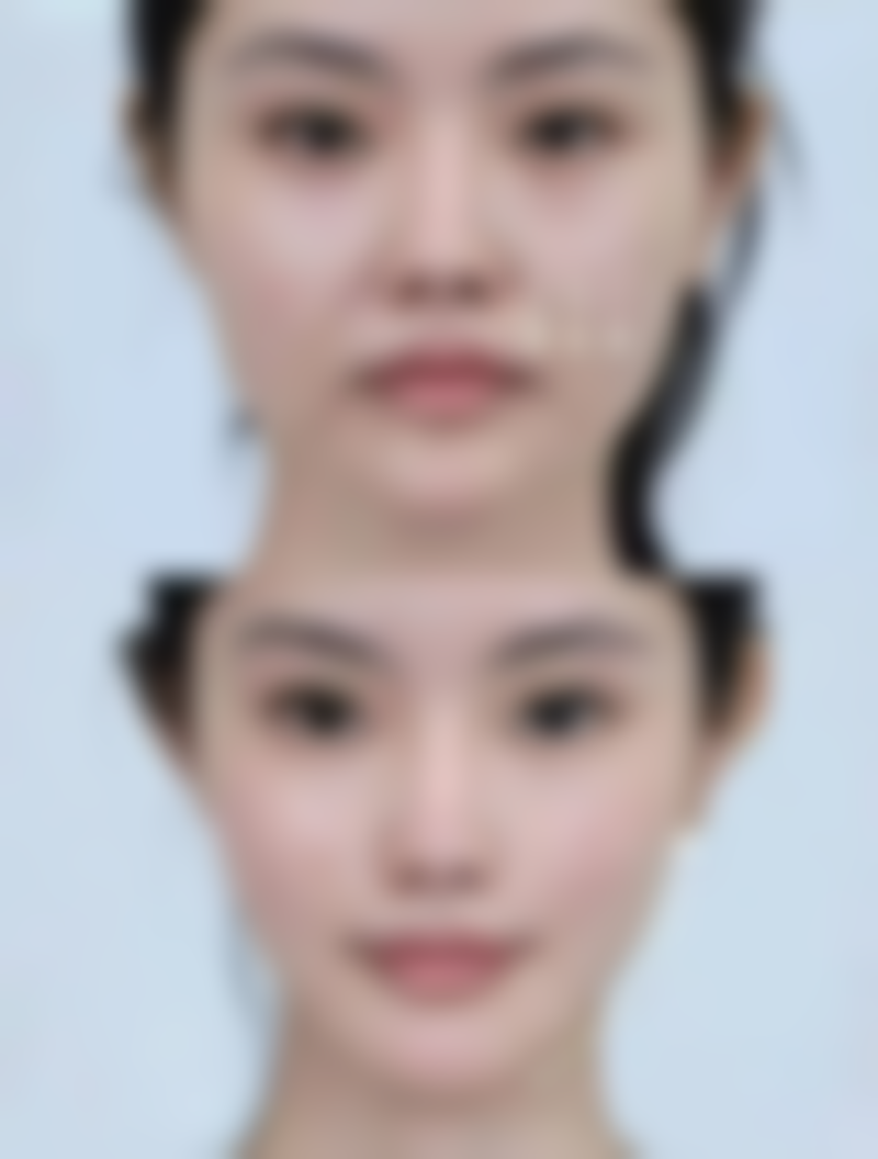 无锡第三人民医院烧伤整形科吕国忠医生社会职称