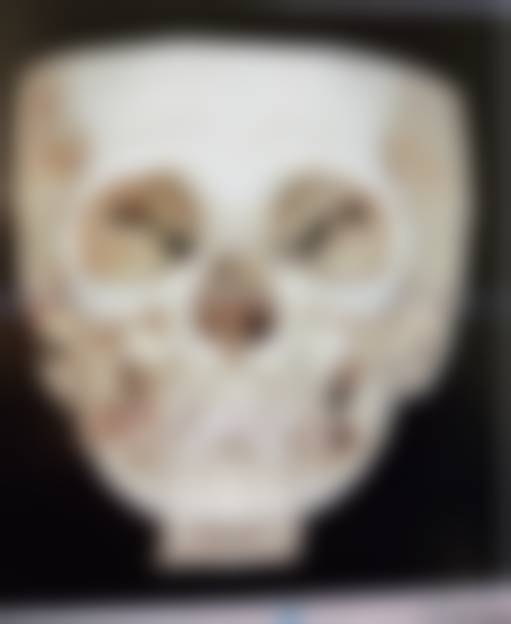 河南大学第一附属医院(整形外科)怎么预约