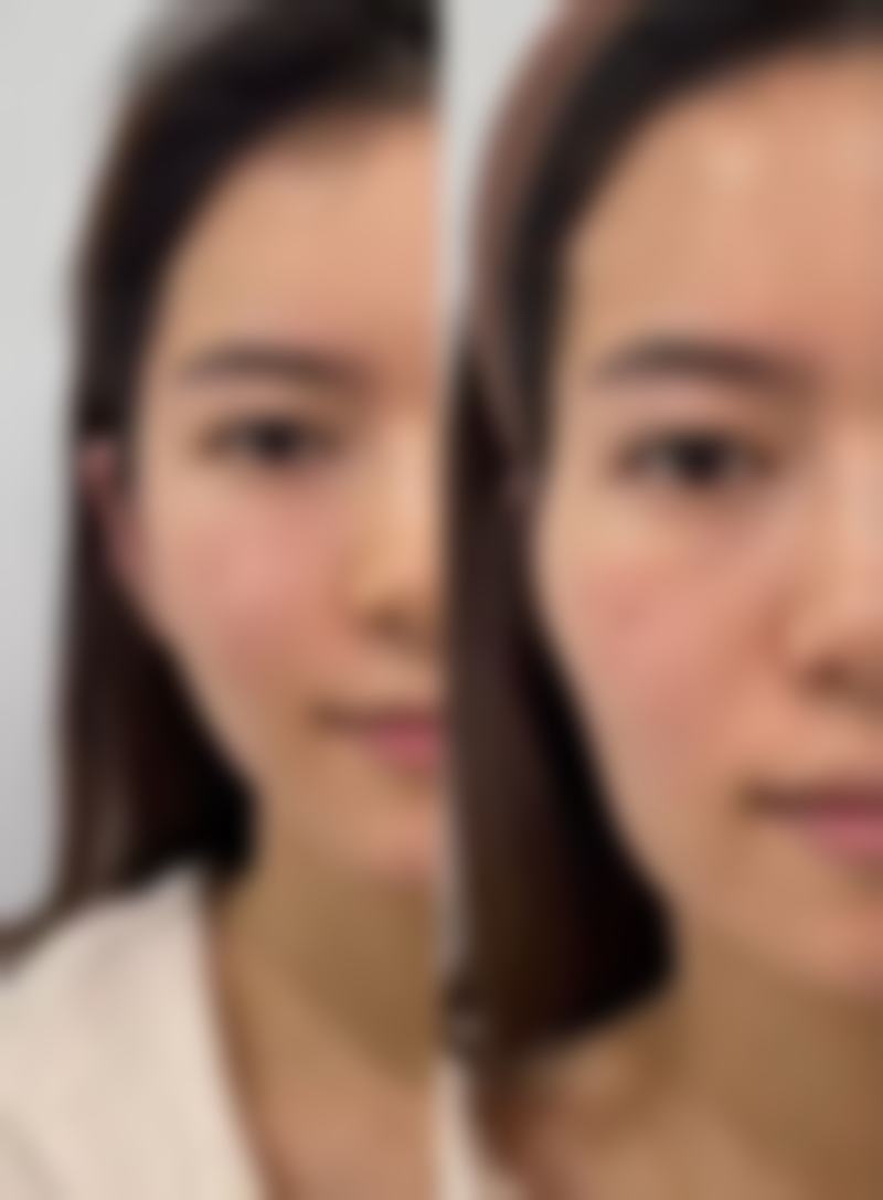 厦门174医院整形美容科阮南杰医生预约挂号指南