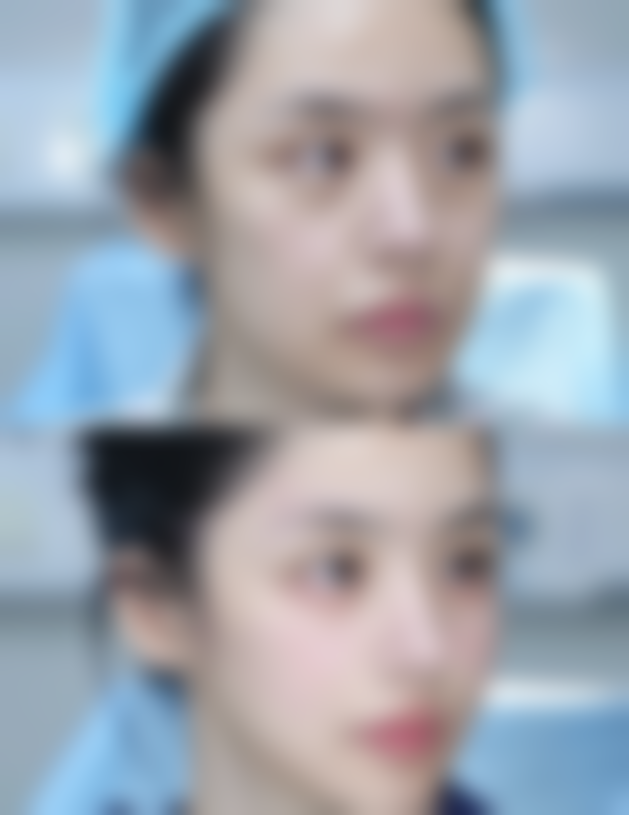 无锡第三人民医院烧伤整形科严炯医生患者评价